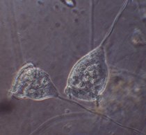 Vorticella campanula