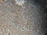 Same objective, in diffraction contrast
