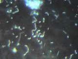 Same objective, in dark field: blurring from irradiation