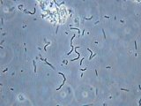 Lactic acid bacteriae in yoghurt, objective PH40x