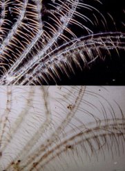 tentacles of a small marine crayfish near Helgoland (Germany) magnified 250 times 